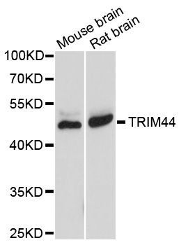 Western blot - TRIM44 antibody (144-08719)