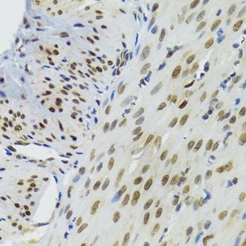 Immunohistochemistry - [KO Validated] BAZ1B Polyclonal Antibody (144-09851)