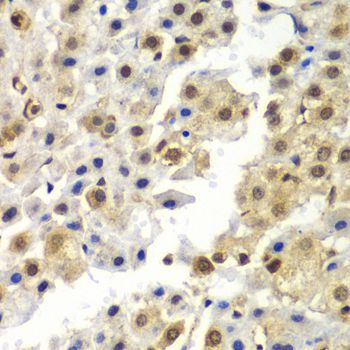 Immunohistochemistry - SYNCRIP Polyclonal Antibody (144-07219)