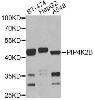 Western blot - PIP4K2B antibody (144-08016)