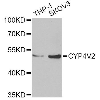 Western blot - CYP4V2 Antibody (144-06573)