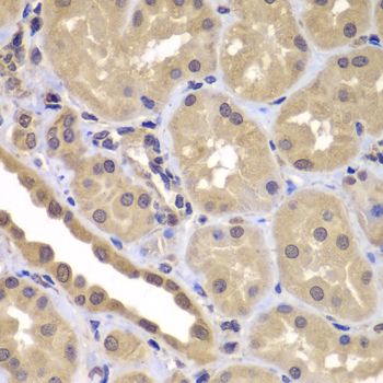 Immunohistochemistry - BAG2 Polyclonal Antibody (144-07763)