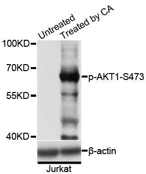Western blot - Phospho-AKT1-S473 pAb (144-61491)