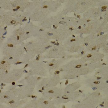 Immunohistochemistry - NFKB2 Polyclonal Antibody (144-03108)