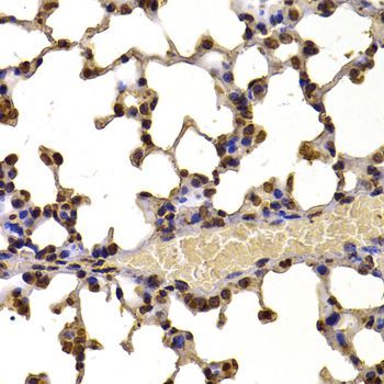 Immunohistochemistry - WHSC1 Polyclonal Antibody (144-07938)