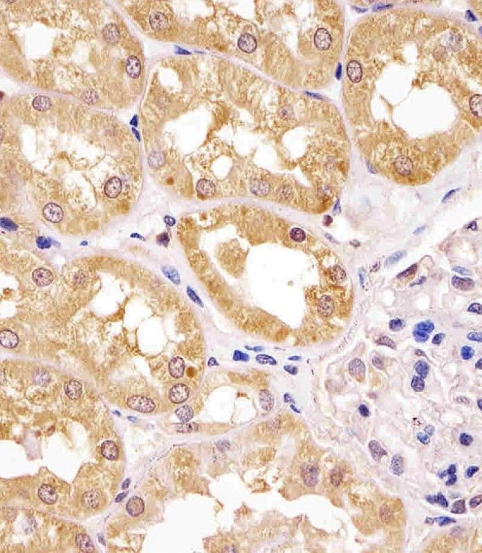 IHC-P