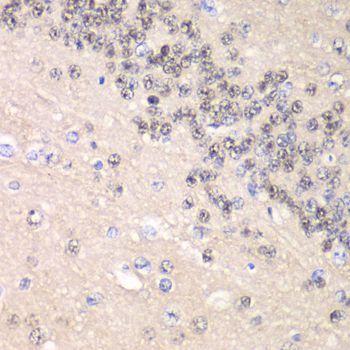 Immunohistochemistry - CCNC Polyclonal Antibody (144-06545)