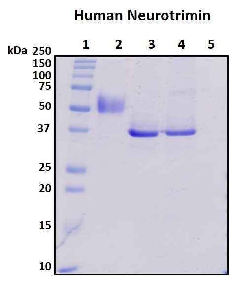 SDS-PAGE