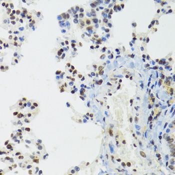 Immunohistochemistry - [KO Validated] BAZ1B Polyclonal Antibody (144-09851)