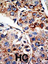 IHC-P