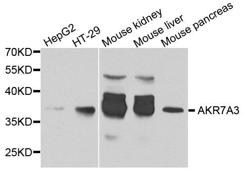 Western blot - AKR7A3 antibody (144-08194)