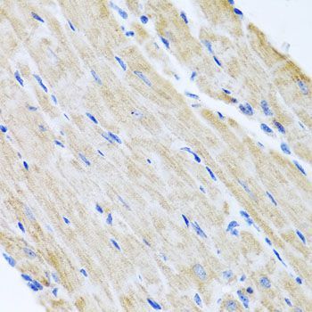 Immunohistochemistry - ABCB8 antibody (144-02653)