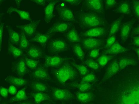 Immunofluorescence - RAD17 Polyclonal Antibody (144-05359)