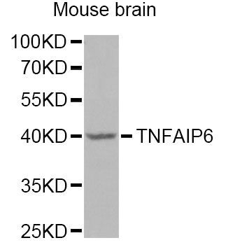 Western blot - TNFAIP6 Antibody (144-06419)