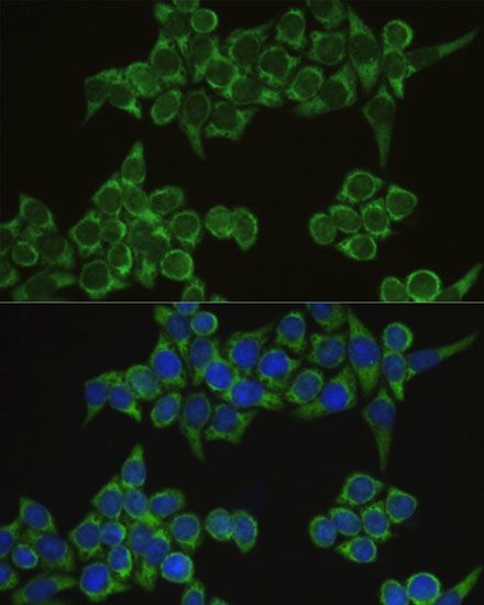 Immunofluorescence - IRF3 Polyclonal Antibody (144-02172)