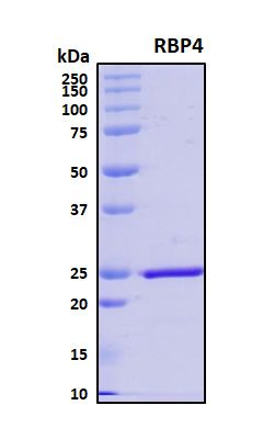 SDS-PAGE