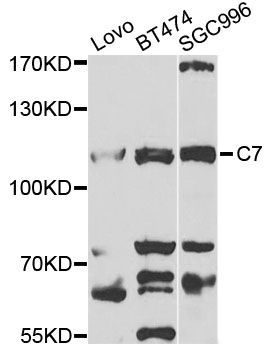 Western blot - C7 antibody (144-05394)