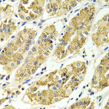 Immunohistochemistry - ARHGAP25 antibody (144-01223)
