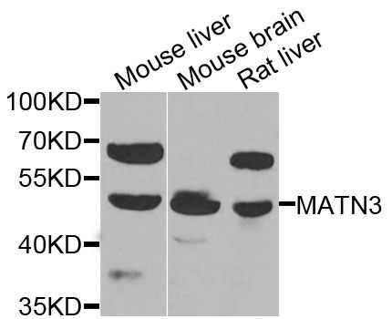 Western blot - MATN3 antibody (144-07700)