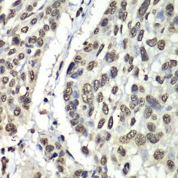 Immunohistochemistry - HNRNPM Polyclonal Antibody (144-06937)