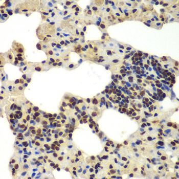 Immunohistochemistry - DDX5 antibody (144-60268)
