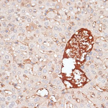 Immunohistochemistry - KIR3DL3 Polyclonal Antibody (144-10064)