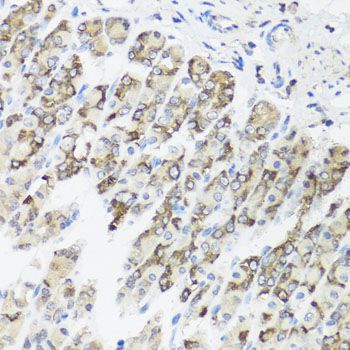 Immunohistochemistry - TIMM10B Polyclonal Antibody (144-08488)