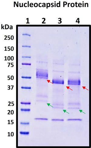 SDS-PAGE