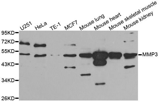 Western blot - MMP3 antibody (144-01202)