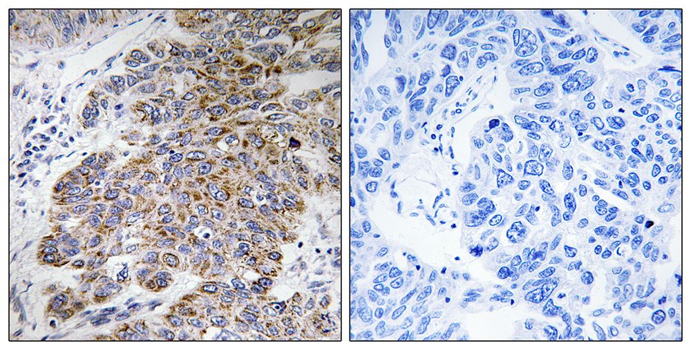 IHC