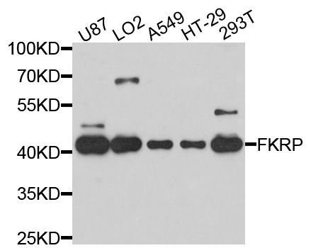Western blot - FKRP Polyclonal Antibody (144-10194)