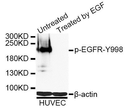Western blot - Phospho-EGFR-Y998 antibody (144-50024)