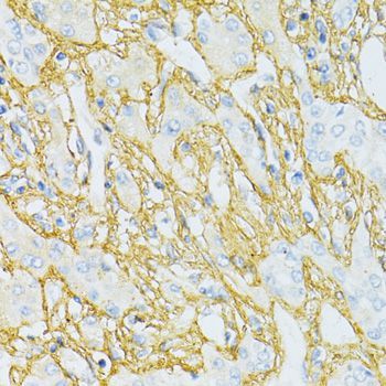 Immunohistochemistry - TGFBI antibody (144-02561)