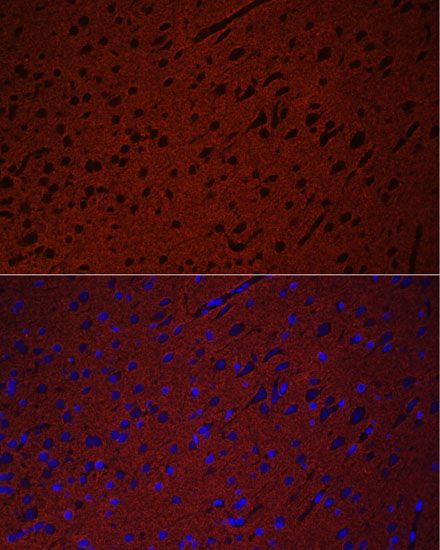 Immunofluorescence - STXBP1 Polyclonal Antibody (144-05420)