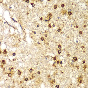 Immunohistochemistry - SMAD9 antibody (144-07518)