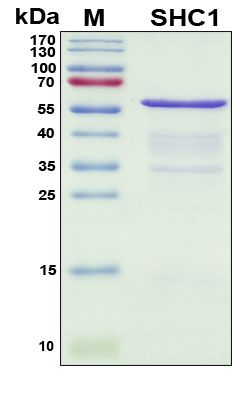 SDS-PAGE