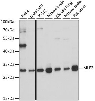 Western blot