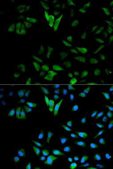 Western blot - ENO1 Polyclonal Antibody (144-01033)