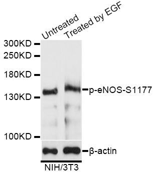 Western blot - n blot analysis of extracts of NIH/3T3 cells,using Phospho-eNOS-S1177 antibody (144-61502)