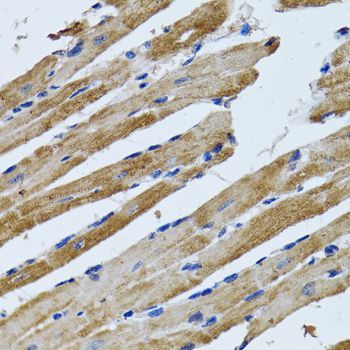 Immunohistochemistry - ATP5B Polyclonal Antibody (144-05769)