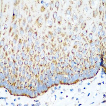 Immunohistochemistry - MT-CO2 antibody (144-011522)