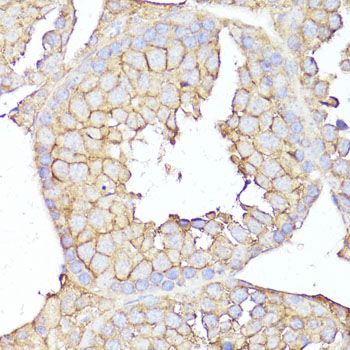 Immunohistochemistry - MME antibody (144-05664)