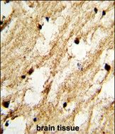 IHC-P
