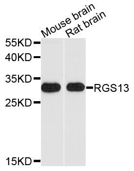 Western blot - RGS13 Polyclonal Antibody (144-10035)