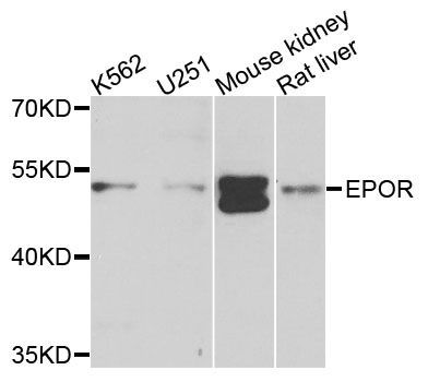Western blot - EPOR Polyclonal Antibody (144-02917)
