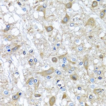 Immunohistochemistry - SERPINA3 Polyclonal Antibody (144-01021)
