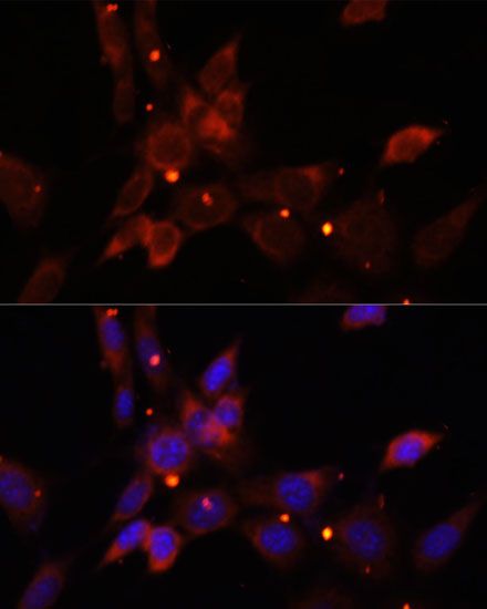 Immunofluorescence - IKBKE Polyclonal Antibody (144-00244)
