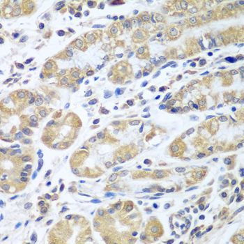 Immunohistochemistry - EIF1AX Polyclonal Antibody (144-05917)
