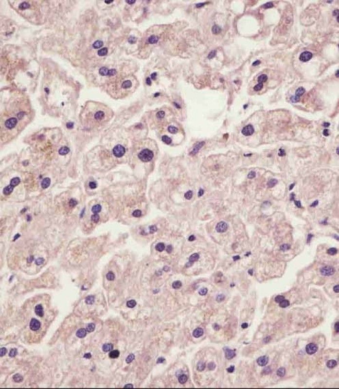 IHC-P