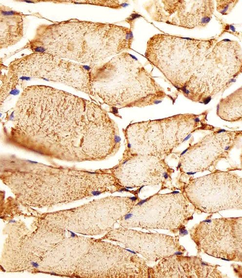 IHC-P